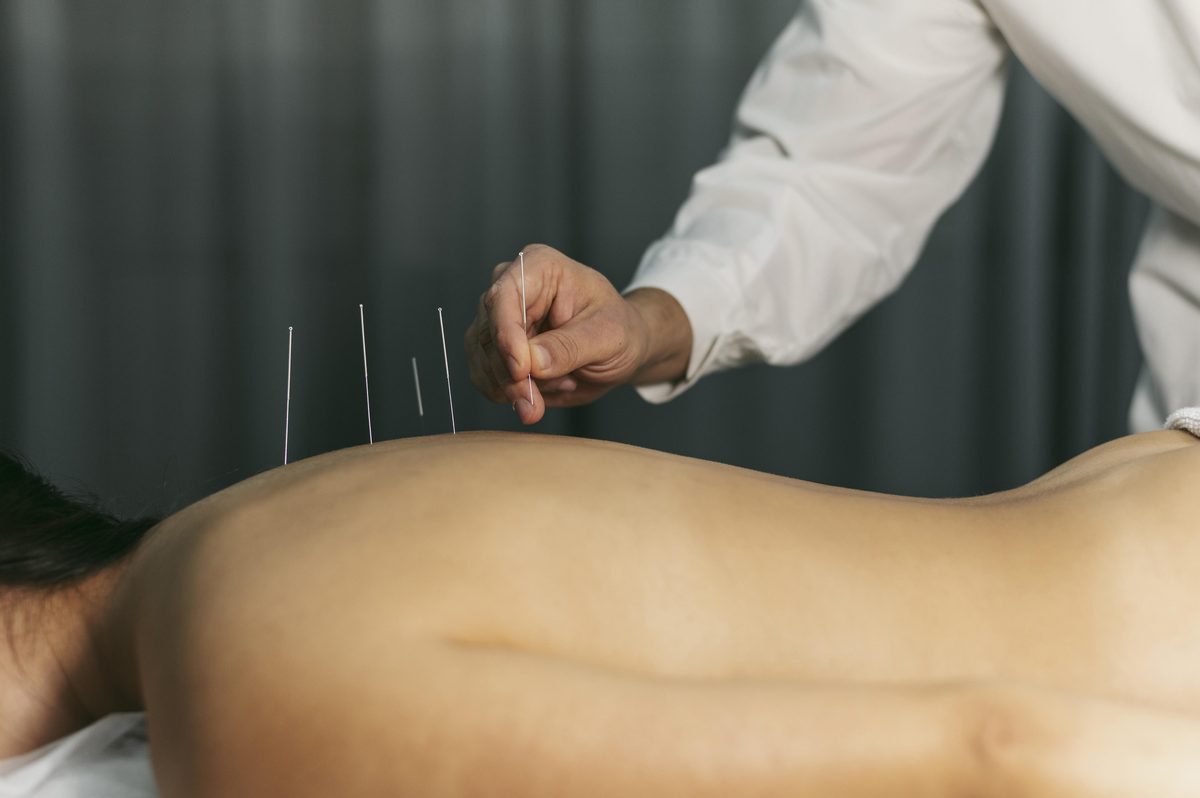 Clinical acupuncture treatment